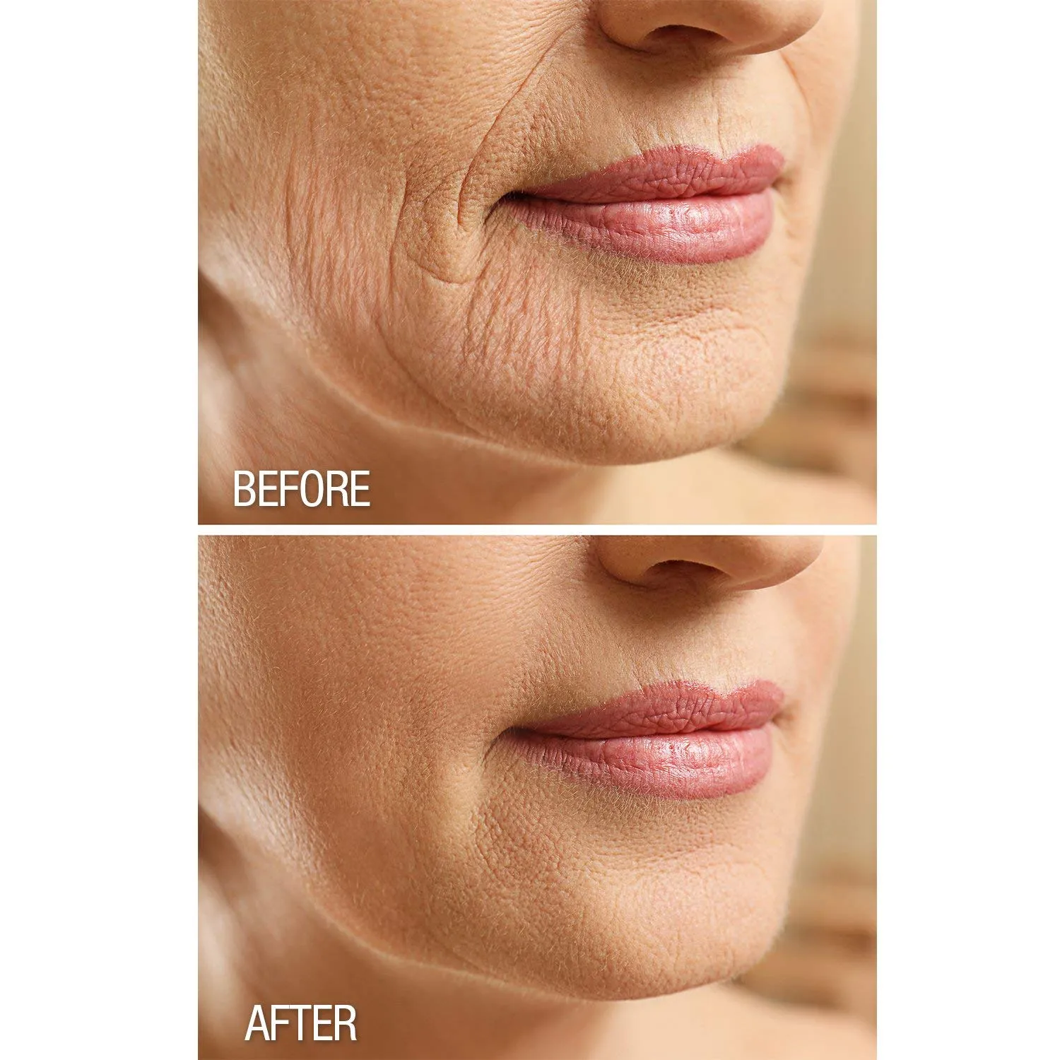Crepe Gone Facial Souffle Anti Aging Skin Cream