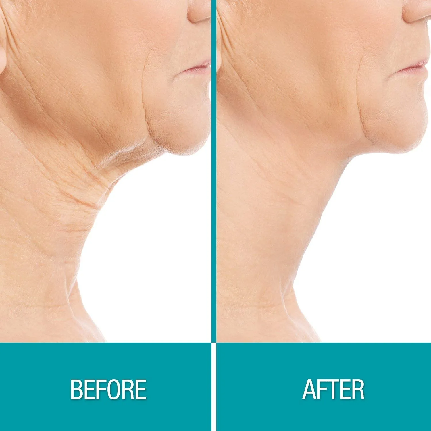 Crepe Gone Facial Souffle Anti Aging Skin Cream